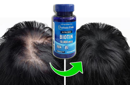 Viên uống mọc tóc Ultra Mega Biotin review-7