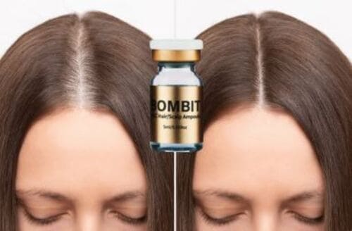 serum-moc-toc-bombit-hsc-ampoule-review-chi-tiet-nguoi-dung-noi-gi1
